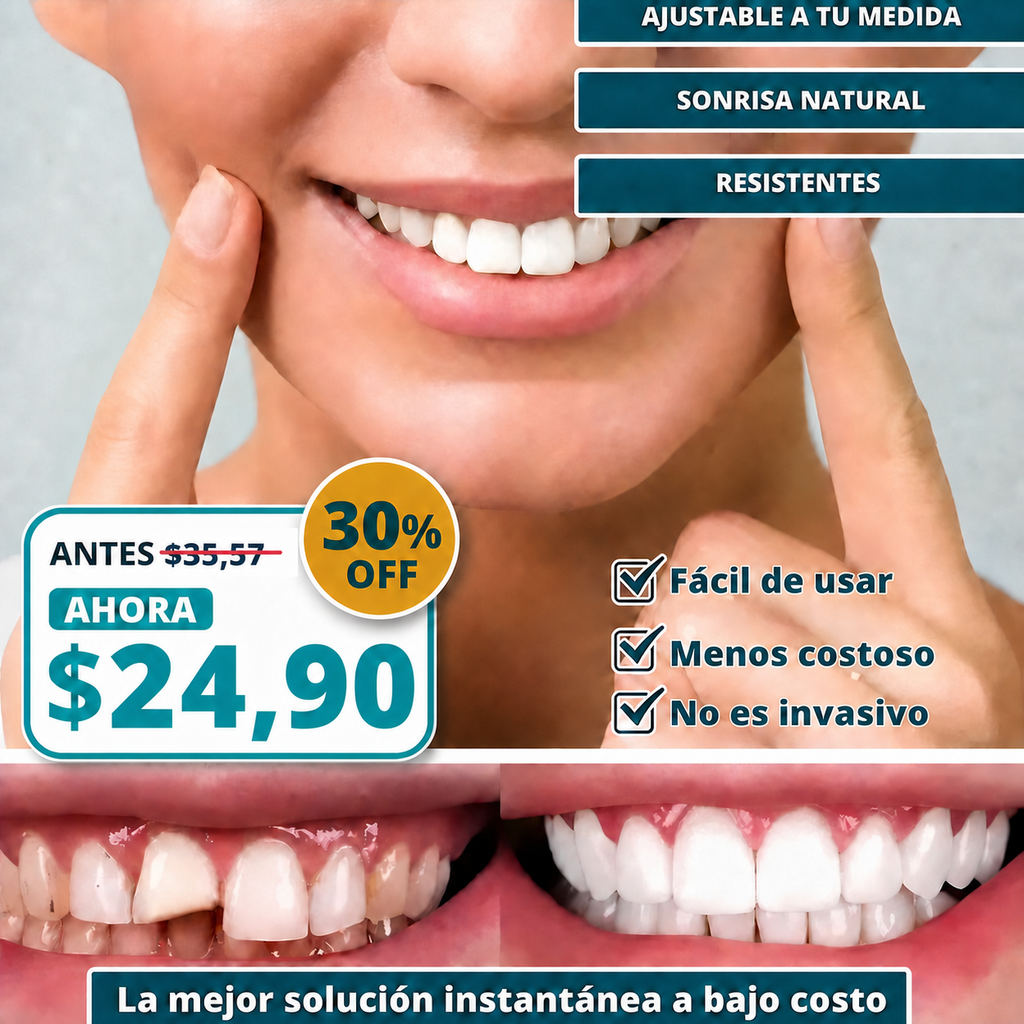 SmilePro 🦷 - Carillas Dentales Ajustables De Resina + ESTUCHE REGALO - ¡Últimas unidades!